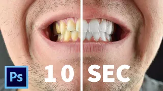 Whiten Teeth in 10 Seconds! (No Clickbait)Adobe Photoshop CC 2021