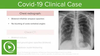 COVID-19 Clinical Case | Lecturio