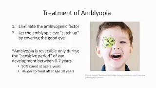 Lazy Eyes and Not So Lazy Eyes: Amblyopia, Strabismus, and Common Pediatric Eye Conditions