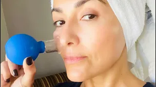 TRATAMIENTO CON VENTOSAS PODRÍA REJUVENECER TU PIEL