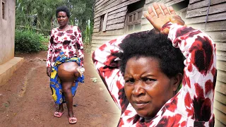 A Mother Of 9 With Giant Leg Tumor Lost Hope and This happened