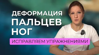 Шишка на стопе? Убираем простыми упражнениями