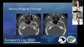 S2E3: Lockjaw (Infratemporal fossa chondrosarcoma)