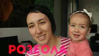 Розеола! Сонечка заболела.=( / Roseola or Sixth Disease.