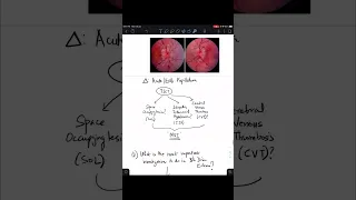 What is the most important investigation you will do in Bilateral Disc Edema?