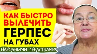 Как быстро вылечить герпес на губах | Народные средства