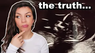 The truth about my pregnancy | Pregnancy Q&A