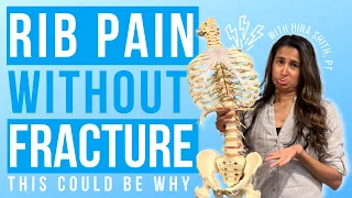 Rib Pain Without a Fracture: Causes, Symptoms, and Treatment Options Explained