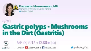 Gastric polyps - Mushrooms in the dirt (GASTRITIS)