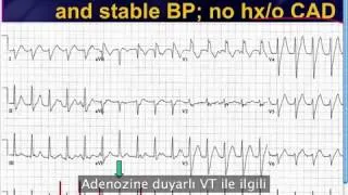 Amal Mattu'nun Haftalık EKG Vakası: VT Bölüm II - Adenozin - 2 Eylül 2013