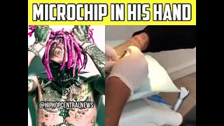 KidBuu Gets a Microchip implanted in his hand and give a strange message