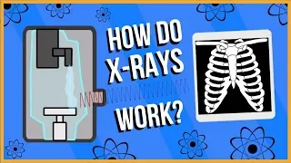 How do X-Rays Work?