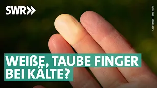 Wenn Kälte zu Schmerzen führt: Raynaud Syndrom und Co. | Marktcheck SWR