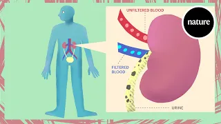 Acute kidney injury explained