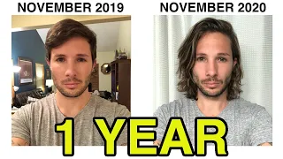 Hair Growth Time Lapse - 1 Year | Men's Hair Growth