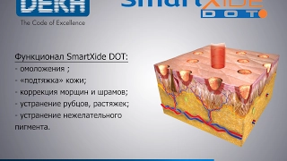 Фракционный лазер CO2 SmartXide DOT - Deka Ukraine