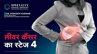 लीवर कैंसर का स्टेज 4 | Stage 4 of liver cancer in Hindi | Dr Praveen Kammar , SSO Hospital- Mumbai