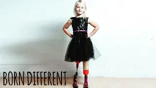 The Little Girl With No Legs And Big Dreams | BORN DIFFERENT