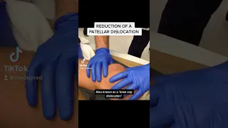 Reduction of a Patellar Dislocation