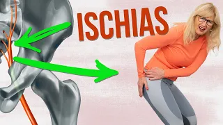 Ischias Übungen ✅ Meine 2 besten Übungen bei Ischias Schmerzen