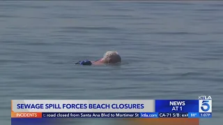 Long Beach beaches closed due to massive sewage spill