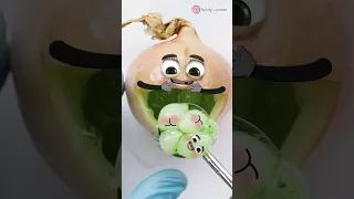 MORE THAN 20 BABIES😱🧅  - Mrs Onion Birth #foodsurgery #fruitsurgery #csection