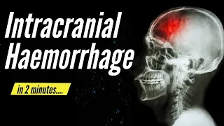 Intracranial Haemorrhage in 2 minutes