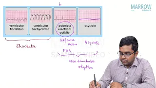 Paediatrics : Algorithm/Protocol for CPR -  Marrow Edition 5 (Clinical Core) Sample Video