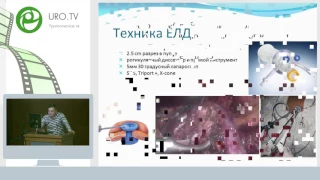 Симанков И В - Минимально инвазивные методики лапароскопии в органосохраняющем лечении локализованн