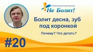 Болит десна, ноет зуб под коронкой при нажатии