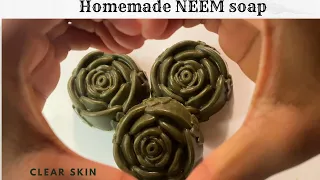 Homemade Neem soap for clear, Bright And Acne Free Glowing Skin