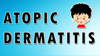 Atopic Dermatitis