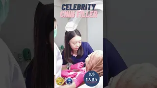 Celebrity Chin & Hollywood Jawline Filler @ Yada Clinic Pattaya