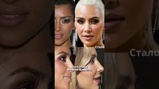 Выглядит Ким Кардашьян на свой возраст? #звезды #косметолог #косметология #клиника #kimkardashian