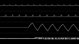 Tim Follin - "Pictionary (NES)" Full Soundtrack [Oscilloscope View]