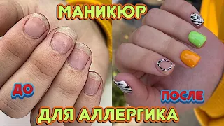 Маникюр при Аллергии на любое покрытие 💅 Гель лаки для аллергиков 💅 Красивые ногти