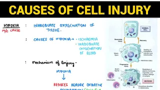 Cell Injury (1/2) | Causes of Cell Injury | Pathology | EOMS