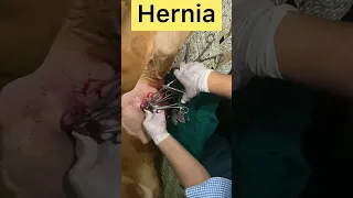 Hernia l Dr Umar Khan