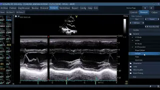 46th Basic Course of Echo, 16-10-22 Measurements-3