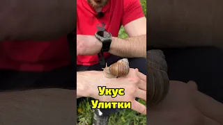 Что делать если укусила улитка