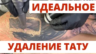 ИДЕАЛЬНОЕ УДАЛЕНИЕ ТАТУ лазером за 5 МЛН РУБЛЕЙ! ПРАВИЛЬНОЕ лазерное удаление.