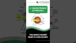 Types of Refractive errors || Eye errors explanation