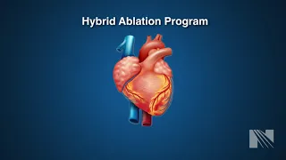 Atrial Fibrillation Treatment: Hybrid Atrial Fibrillation (AF) Ablation