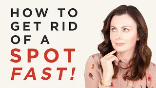How To Get Rid Of A Spot FAST! | Dr Sam Bunting