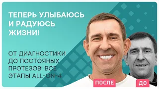 Зубы за 1 день all-on-4 👉 все этапы имплантации