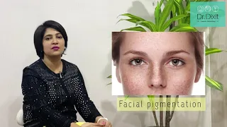 WHAT CAUSES FACIAL PIGMENTATION | DR RASYA DIXIT | TIPS