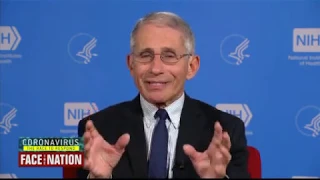 Face The Nation: Fauci Says U.S. Not Like Italy Amid Pandemic