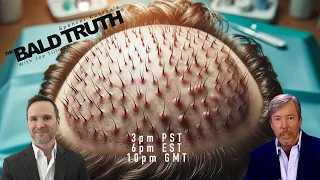 State of The Union of Hair Transplantation  - The Bald Truth - March 8th, 2024