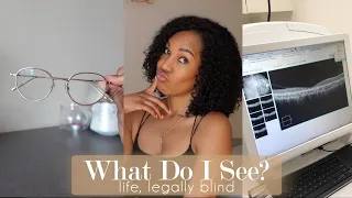 HOW DO LEGALLY BLIND PEOPLE SEE |What Do I See? | What is Stargardt's Disease