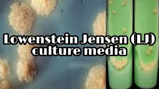 Lowenstein Jensen (LJ) medium: culture media lecture 17